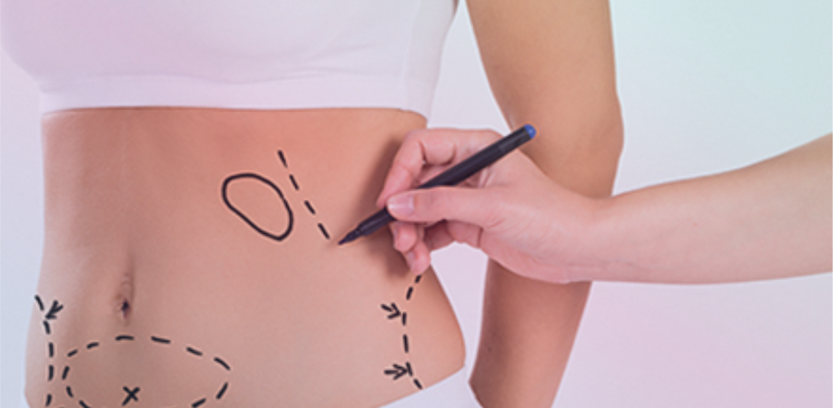 Tudo sobre lipoaspiração